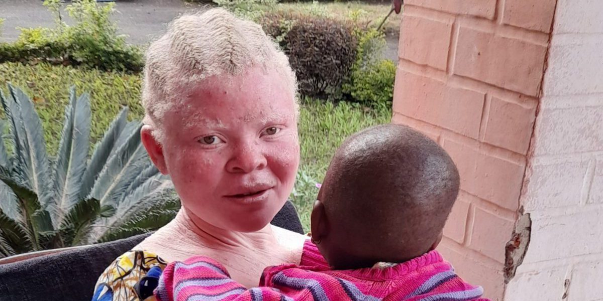 Nyota, survivante de la violence sexiste et défenseuse des albinos, est prête pour sa rencontre avec le pape François en RDC.